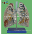 Traitement anatomique humain transparent pulmonaire